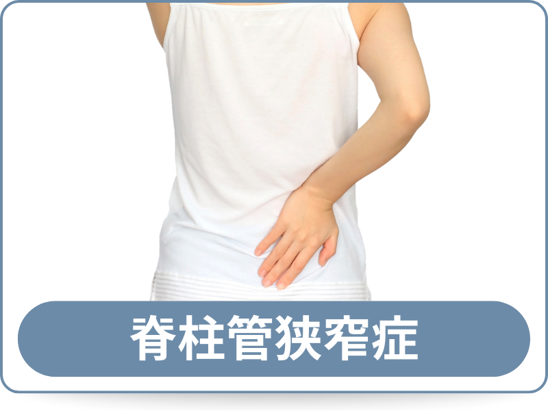 脊柱管狭窄症